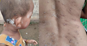 áĄááąááźáŹá¸ááąáŹá፠ááśá
áŹá¸ááąááźááá˛áˇ ááŻáášááŹá¸ááťá˝ááşá¸ááźááŻáˇáááşáĄáá˝ááşá¸á
á
áşáážáąáŹááşáá˝áąáĄááąá¸ááąáŤáşááąá¸ááŤá¸ááąáŹááşááśáˇáážáŻáááŻáĄááşááą