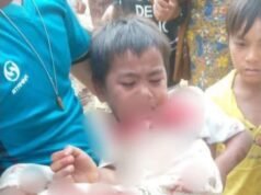 တောင်ကုတ်မှာ စစ်ကျန်လက်နက်ပေါက်ကွဲလို့ ကလေးငယ်တစ်ဦး ဒဏ်ရာရ