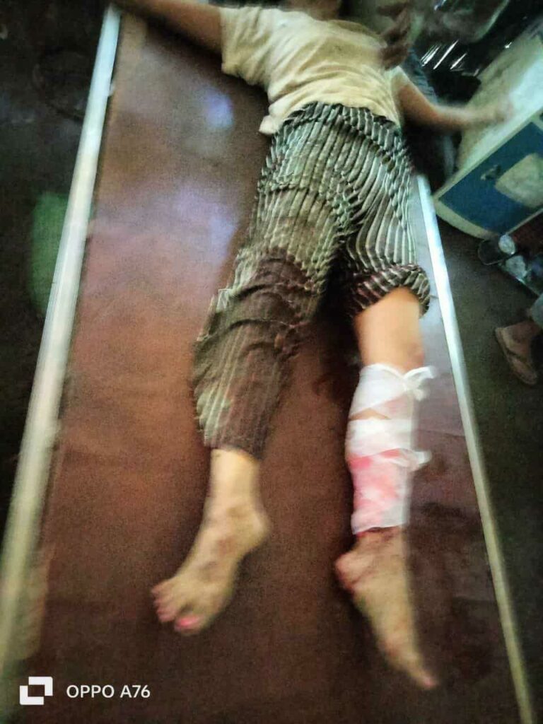 ပုံ - ဒီနေ့လေကြောင်းတိုက်ခိုက်ခံခဲ့ရတဲ့ ပန်းနီလာကျေးရွာဖြစ်စဥ်မြင်တွေ့ရမှု။ပေးပို့