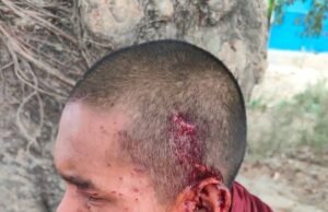 မြောက်ဦးက လူနေကျေးရွာ နဲ့ ဘုန်းတော်ကြီးကျောင်း ဗုံးကြဲတိုက်ခိုက်ခံရမှု ၁၃ ဦးဒဏ်ရာရ