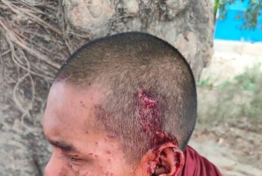 မြောက်ဦးက လူနေကျေးရွာ နဲ့ ဘုန်းတော်ကြီးကျောင်း ဗုံးကြဲတိုက်ခိုက်ခံရမှု ၁၃ ဦးဒဏ်ရာရ